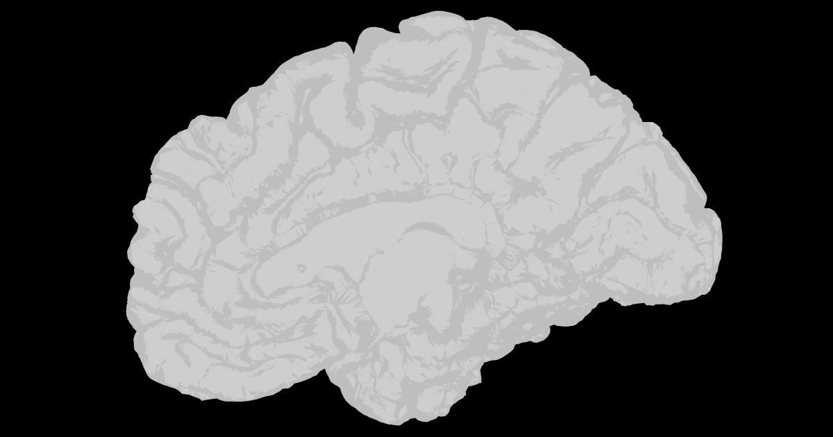 Users with Cognitive Impairments